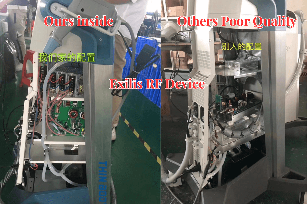 Perangkat rf Exilis dibandingkan dengan komponen berkualitas buruk lainnya