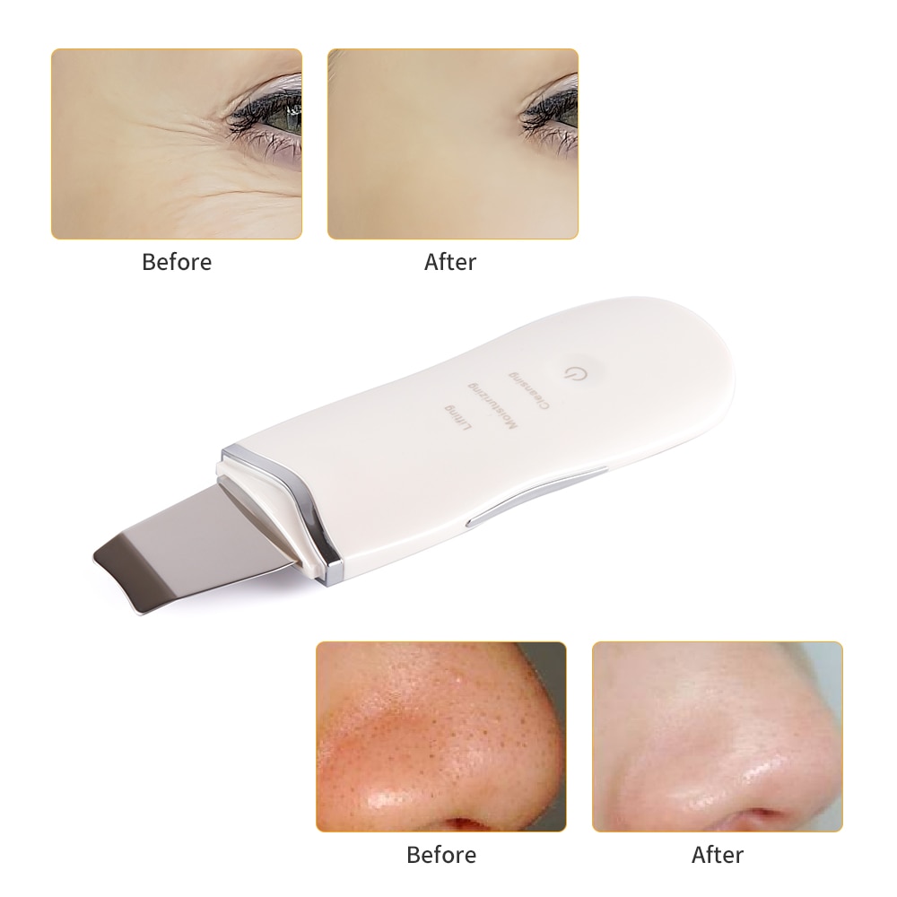 thumbnail image 2 of Captain Green Anti-Aging Facial Scrubber – Exfoliate Blackheads, USB Powered, White 2 of 3