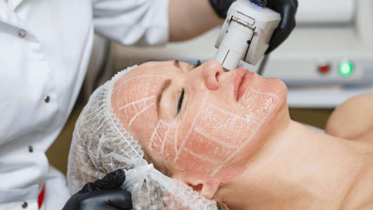 HIFU Makinesi Nasıl Kullanılacağına İlişkin Kullanışlı İpuçları