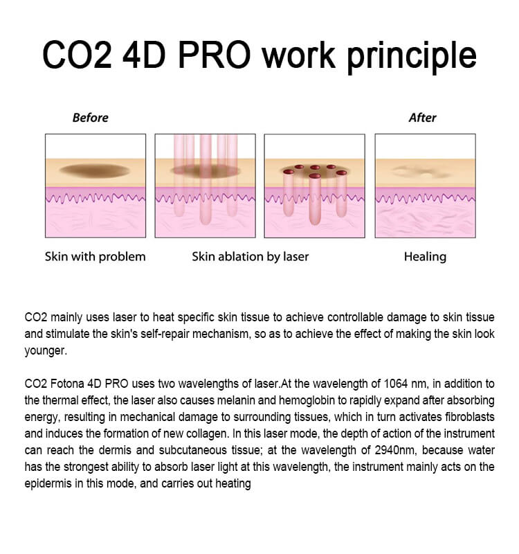 Co2 laser machine 