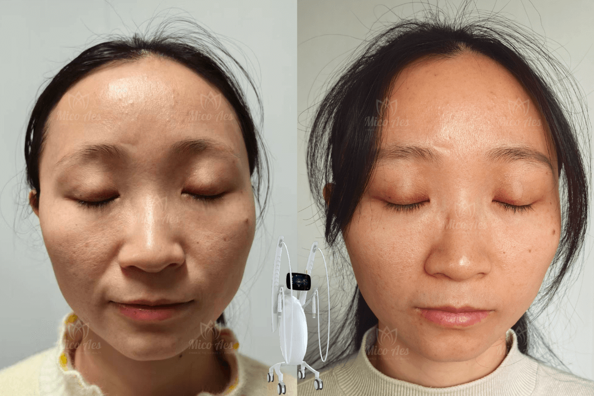 Volnewmer result (1)