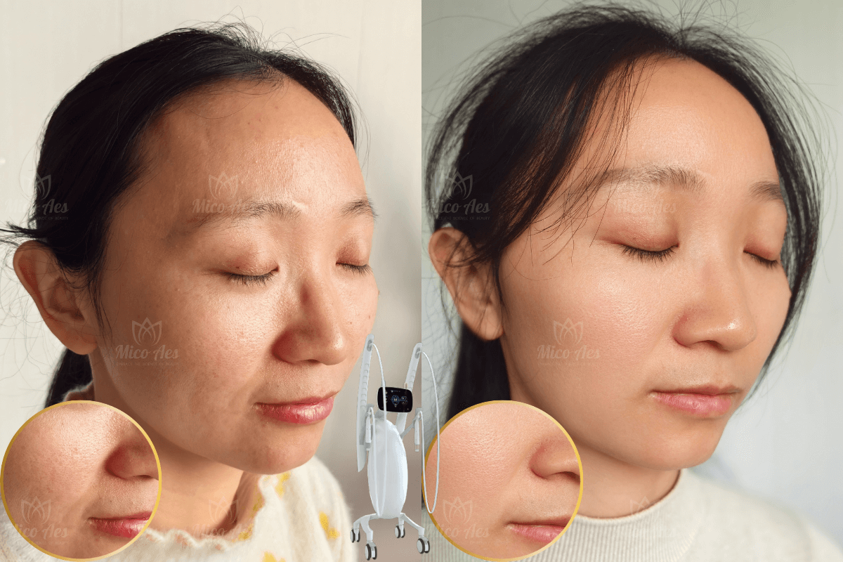 Volnewmer result (2)