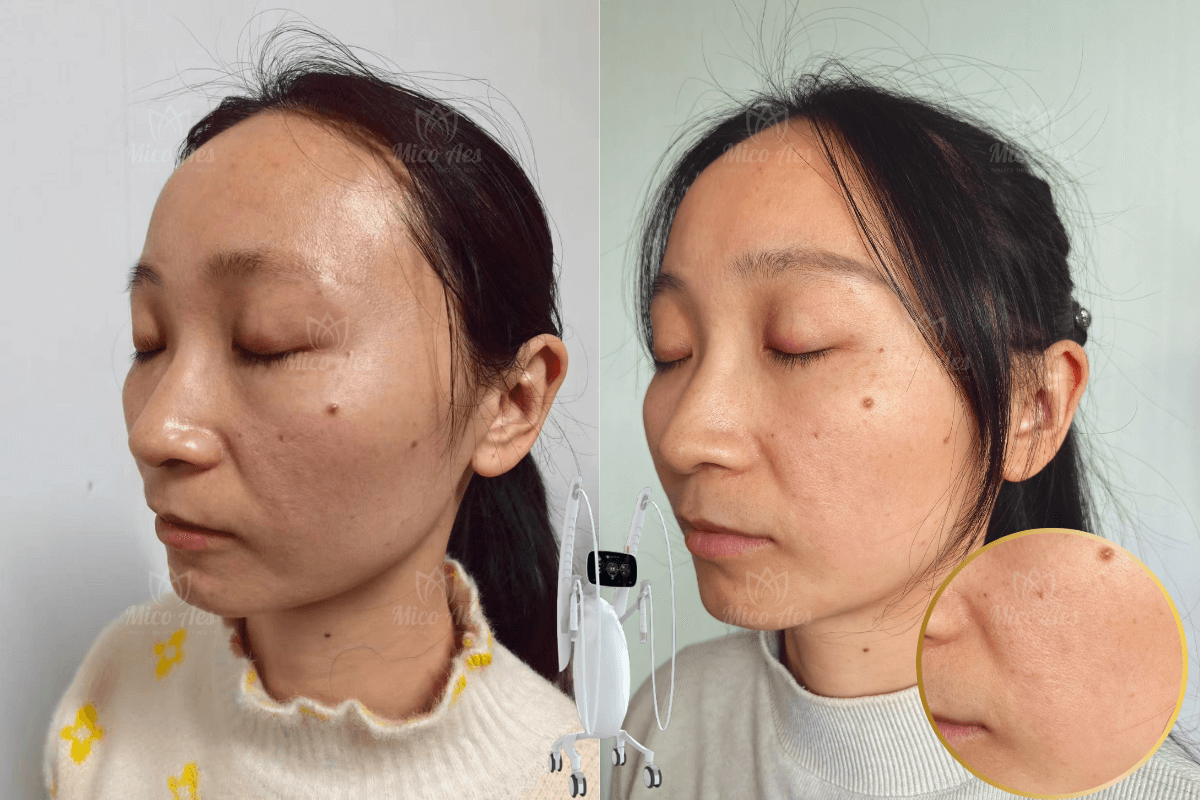 Volnewmer result (3)