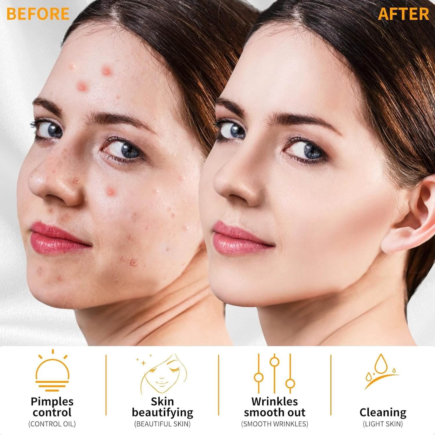 High Frequency Wand before and after