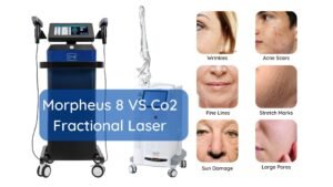Morpheus 8 vs frakcjonalny laser CO2