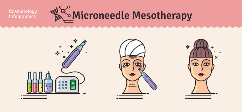 procedimiento de mesoterapia
