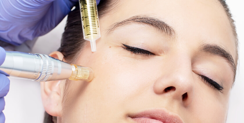 mesoterapia para el rejuvenecimiento facial