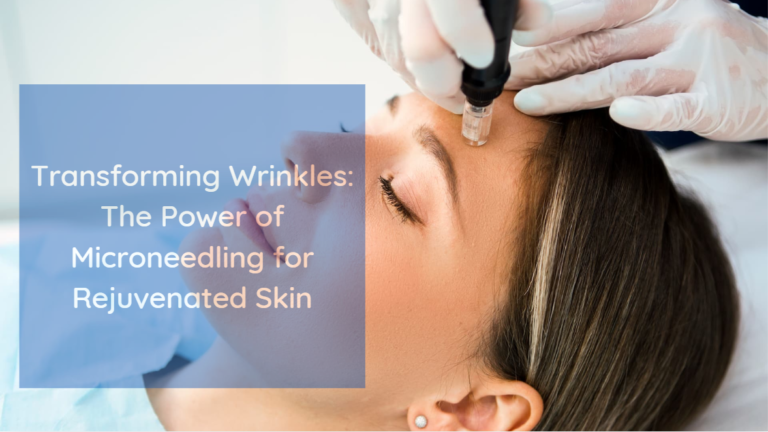 Kırışıklıklar için mikro iğneleme