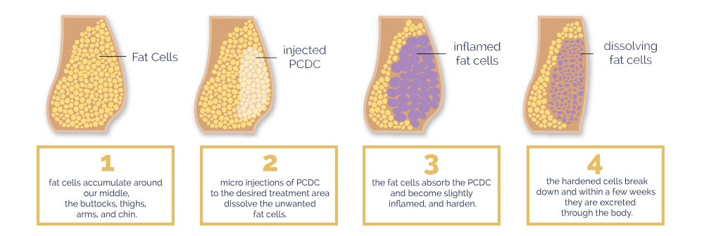 Jak działa mezoterapia?