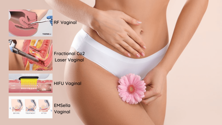 Les technologies de rajeunissement vaginal comparent