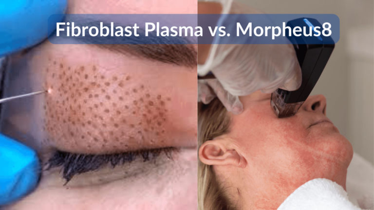 Fibroblast Plazma ve Morpheus8