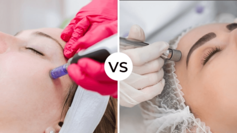 Microdermabrasion vs Microneedling (1)
