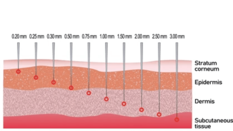 What Needle Length Is Best for Microneedling Deep Acne Scars (1)