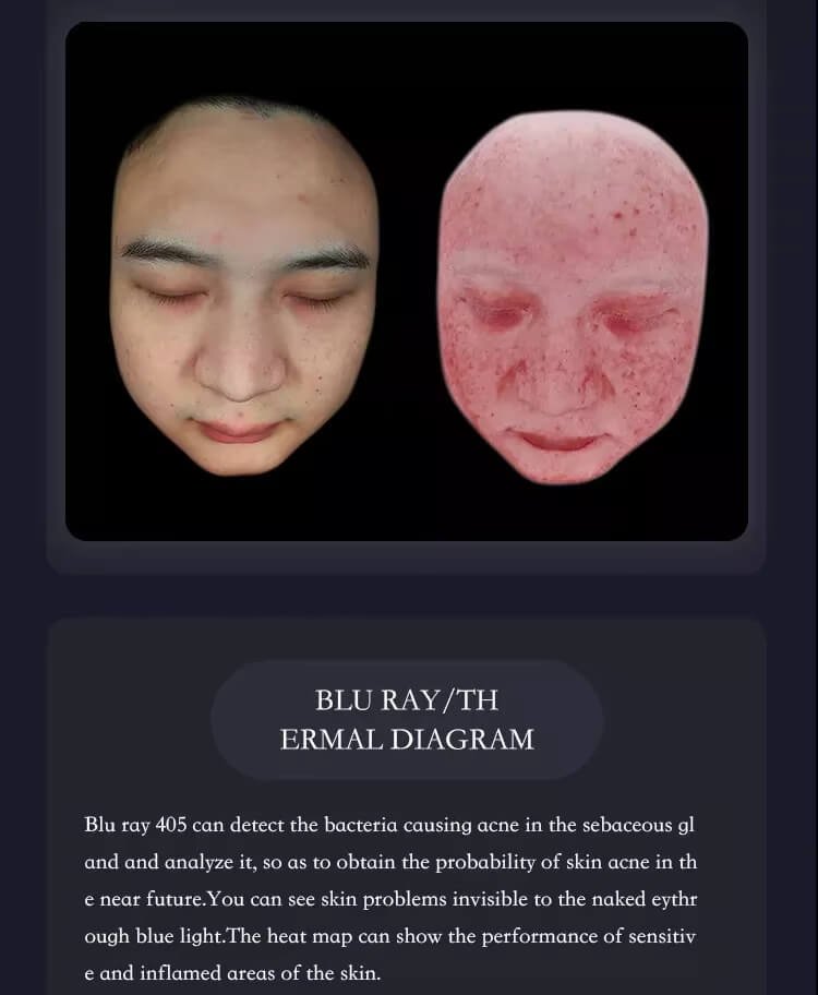 Aisia 3D skin analyzer (14)