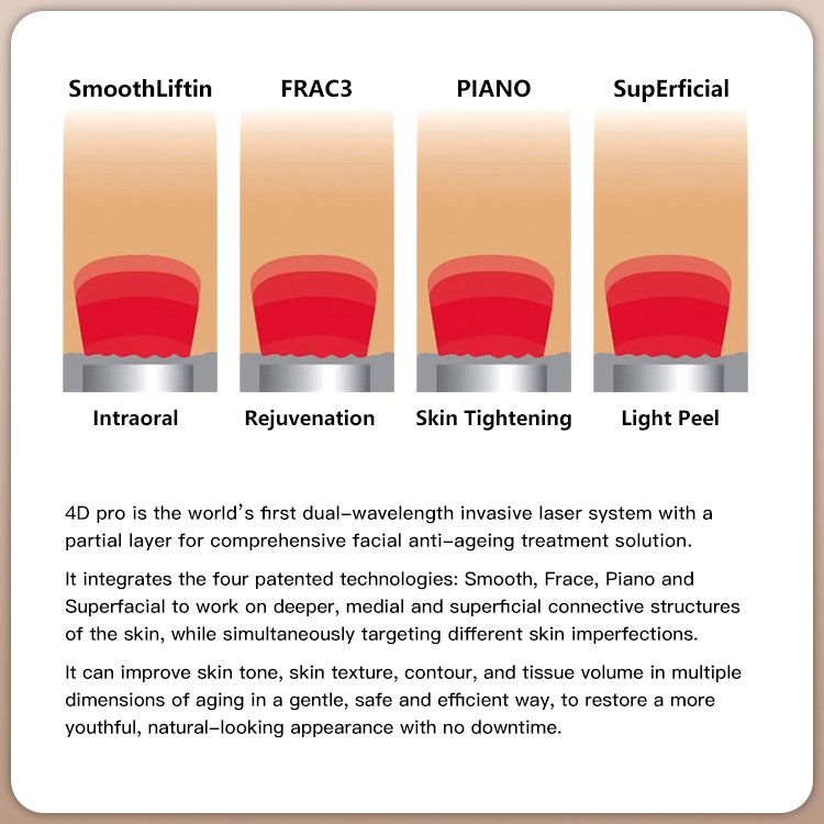 máquina a laser fotona 4d como funciona