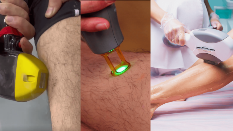 Diode contre Alexandrite vs IPL