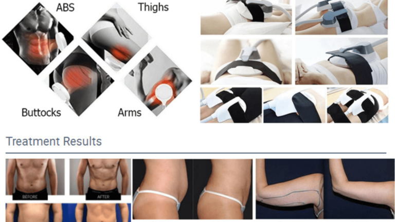 How-tis-emsculpt-compare-to gym-workouts