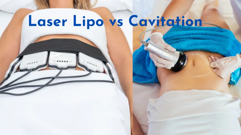 Laser Lipo vs Cavitation