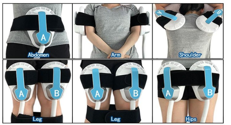 emsculpt handle treated areas