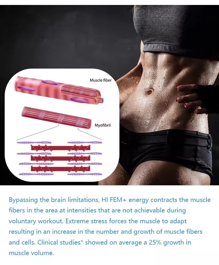 2 In 1 Cryo + Ems Body Slimming Muscle Building 360 Cryo Cool Body Shaping Cryotherapy Machine (3)