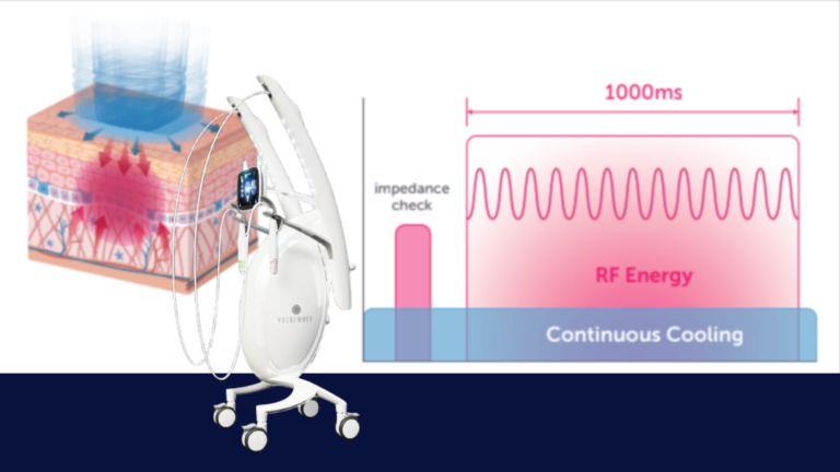 100 questions about thermage (1)