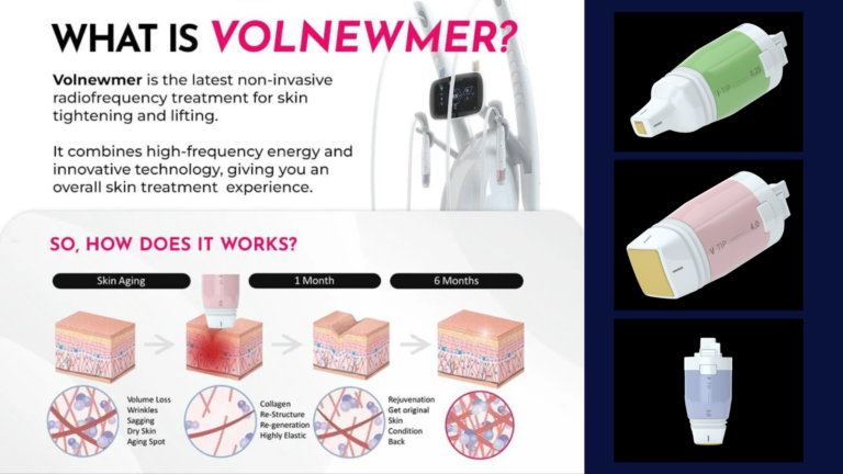 100 questions sur Thermage 1