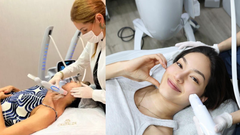 5 Useful Tips for a Comfortable, Painless Volnewmer Thermage!