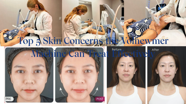 En iyi 5 cilt endişeleri Volnewmer makinesinin etkili bir şekilde tedavi edebileceği