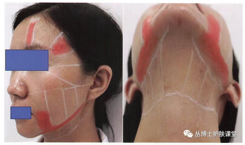 Area merah dalam diagram mewakili zona tanpa perawatan.