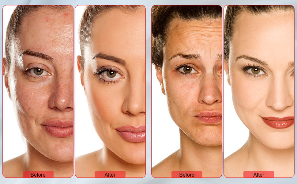 7 colors led therapy device with mist before and after