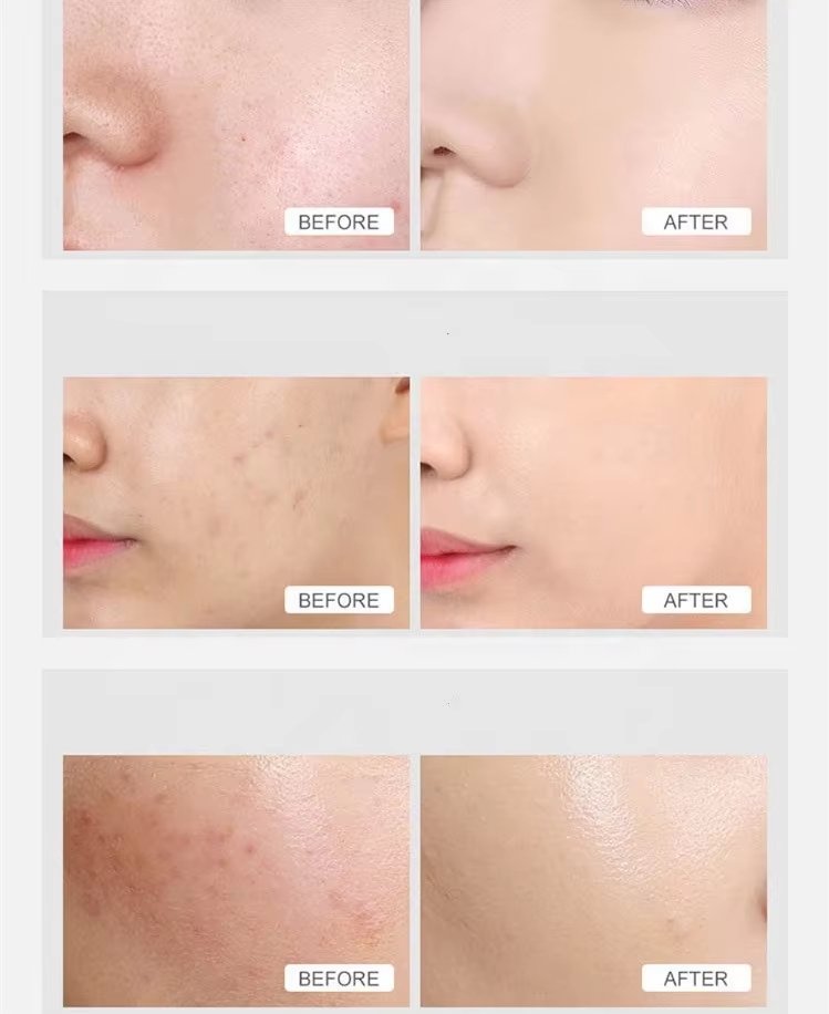 7 warna perangkat terapi LED dengan kabut sebelum dan sesudah