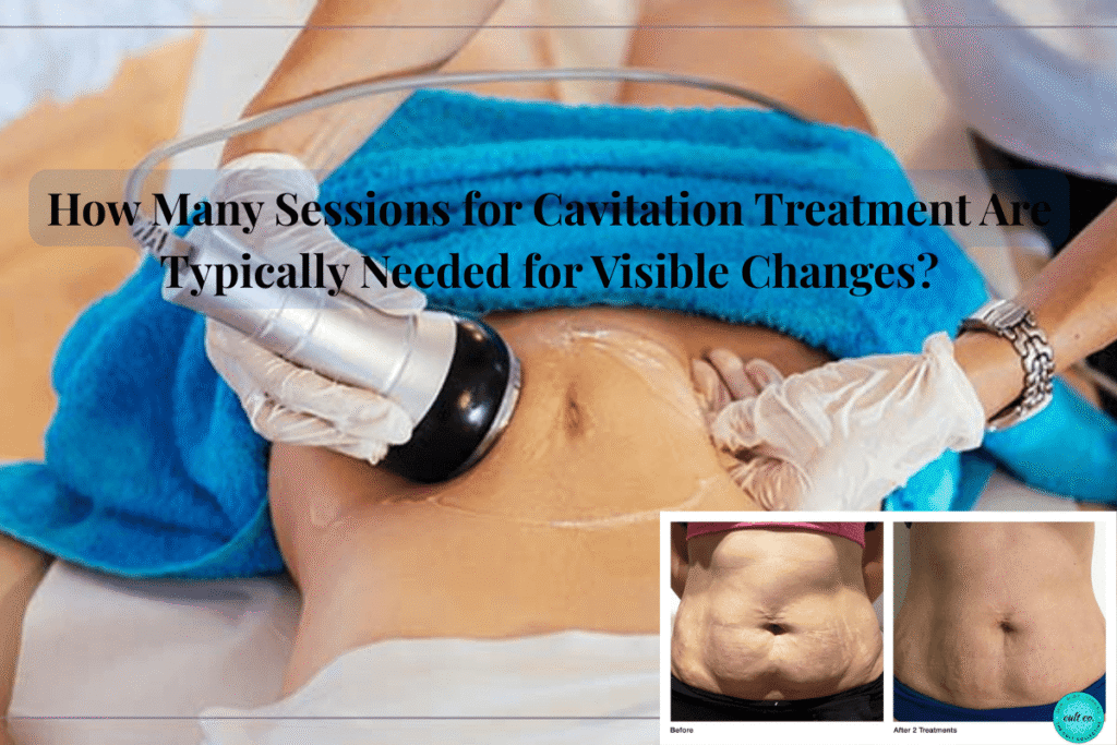 How Many Sessions for Cavitation Treatment Are Typically Needed for Visible Changes