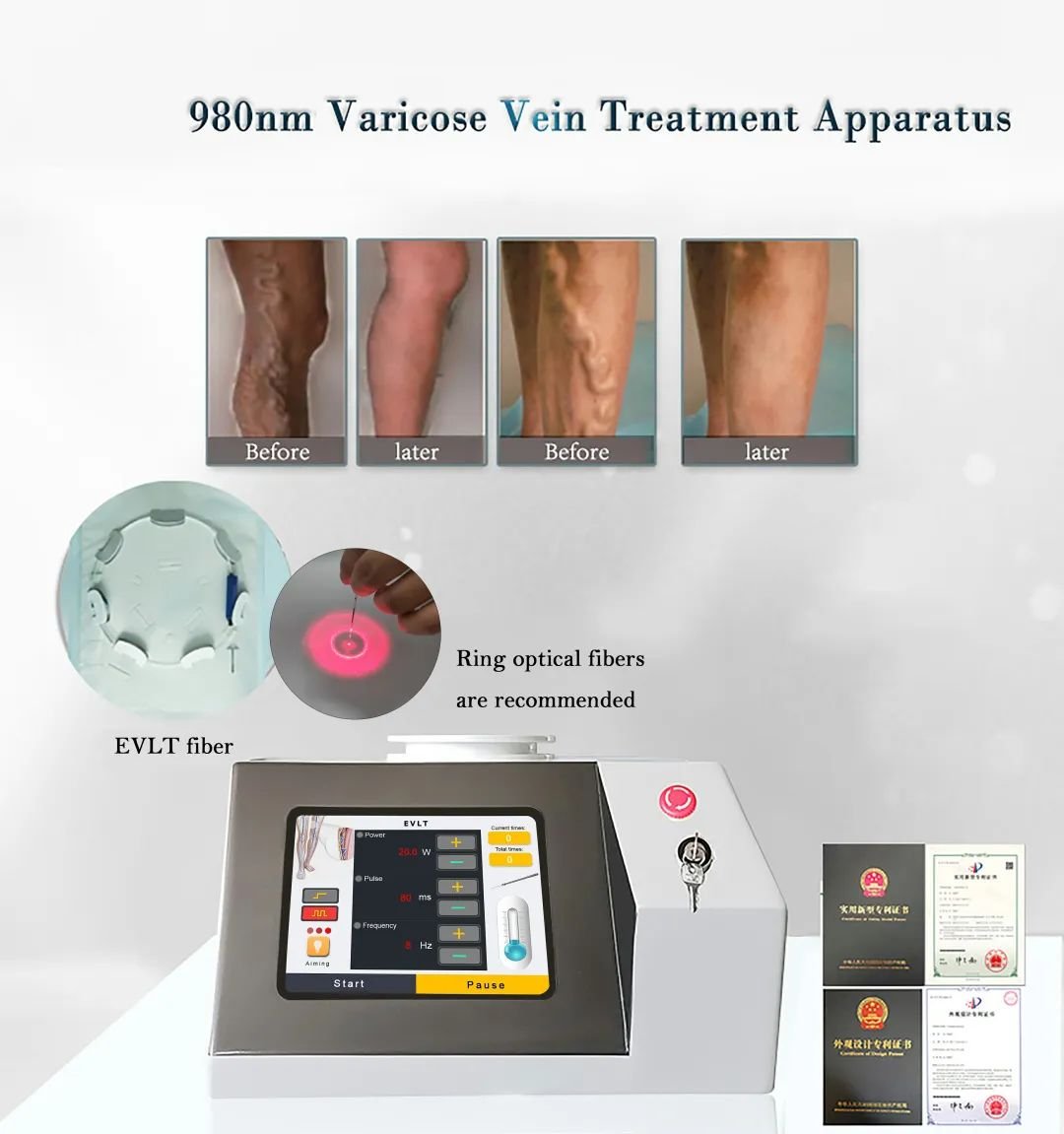 980nm VLST laser machine (4)