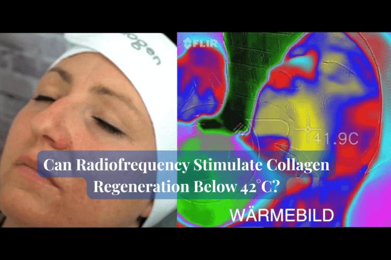 Can Radiofrequency Stimulate Collagen Regeneration Below 42°C