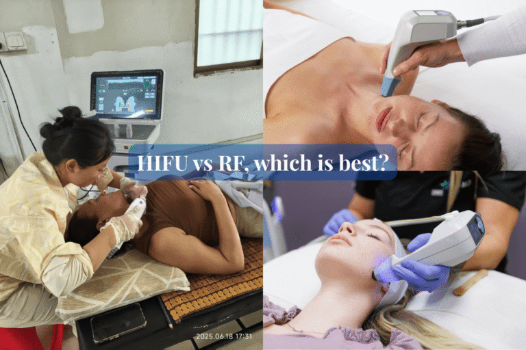 HIFU-vs-RF-which-is-best-for-skin-tightening