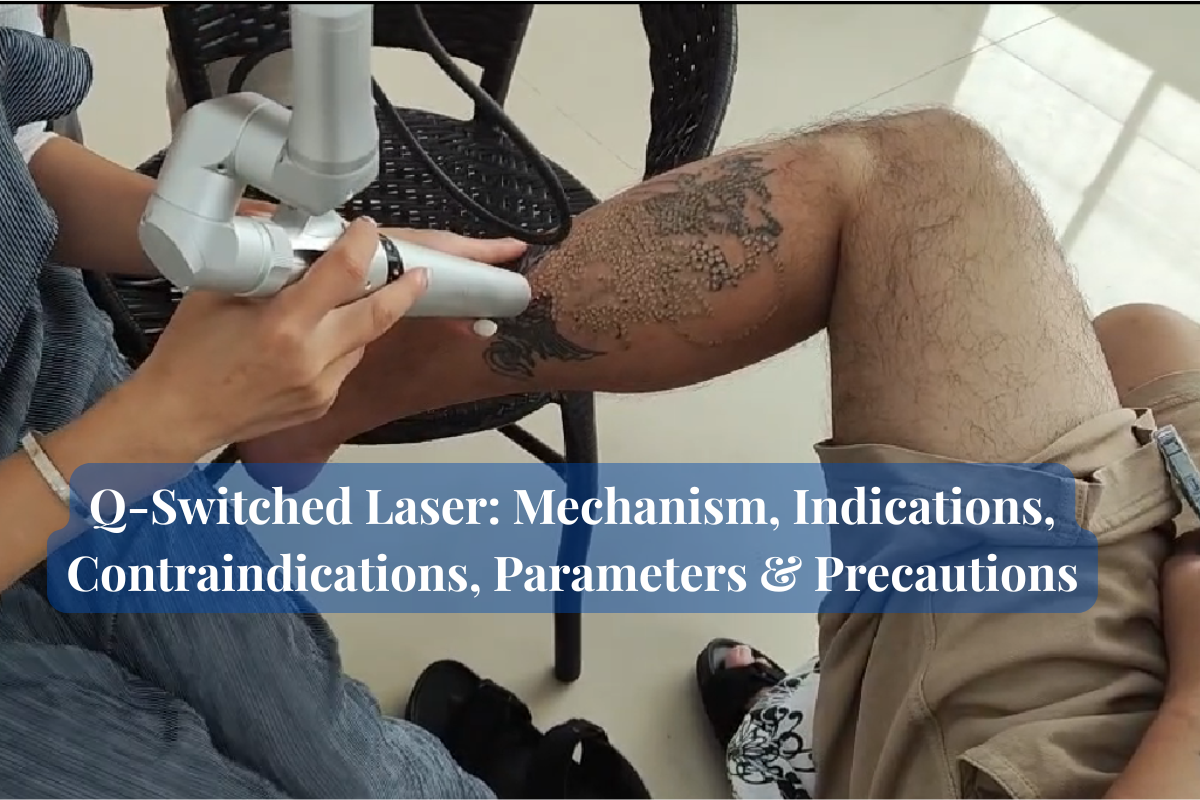 Q-Switched Laser Mechanism, Indications, Contraindications, Parameters & Precautions