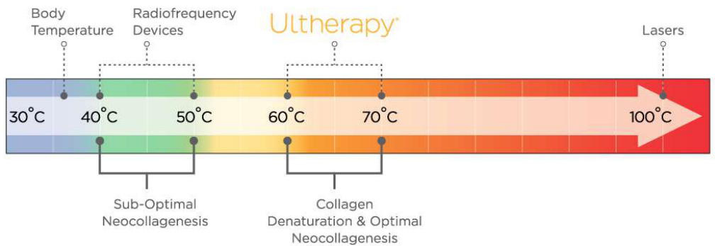 hifu working temperature