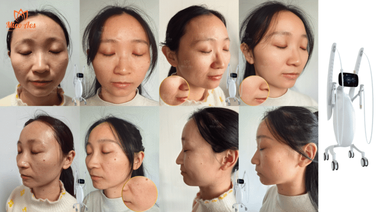 Volnewmer Prima e dopo: quali risultati puoi aspettarti