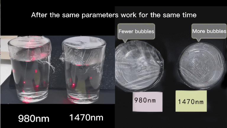 980nm vs 1470nm laser lipolysis